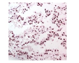 BCL-2 Monoclonal De Coelho CloneaBCL-2 Monoclonal De Coelho Clone (EP36) Pronto Para Uso - 6 Ml - Easypath - EP-12-50163 (EP36) Pronto Para Uso - 1 Ml - Easypath - EP-12-50161